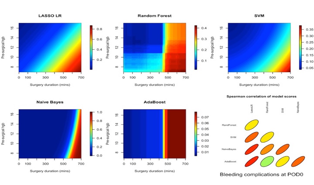 machine learning algorithms