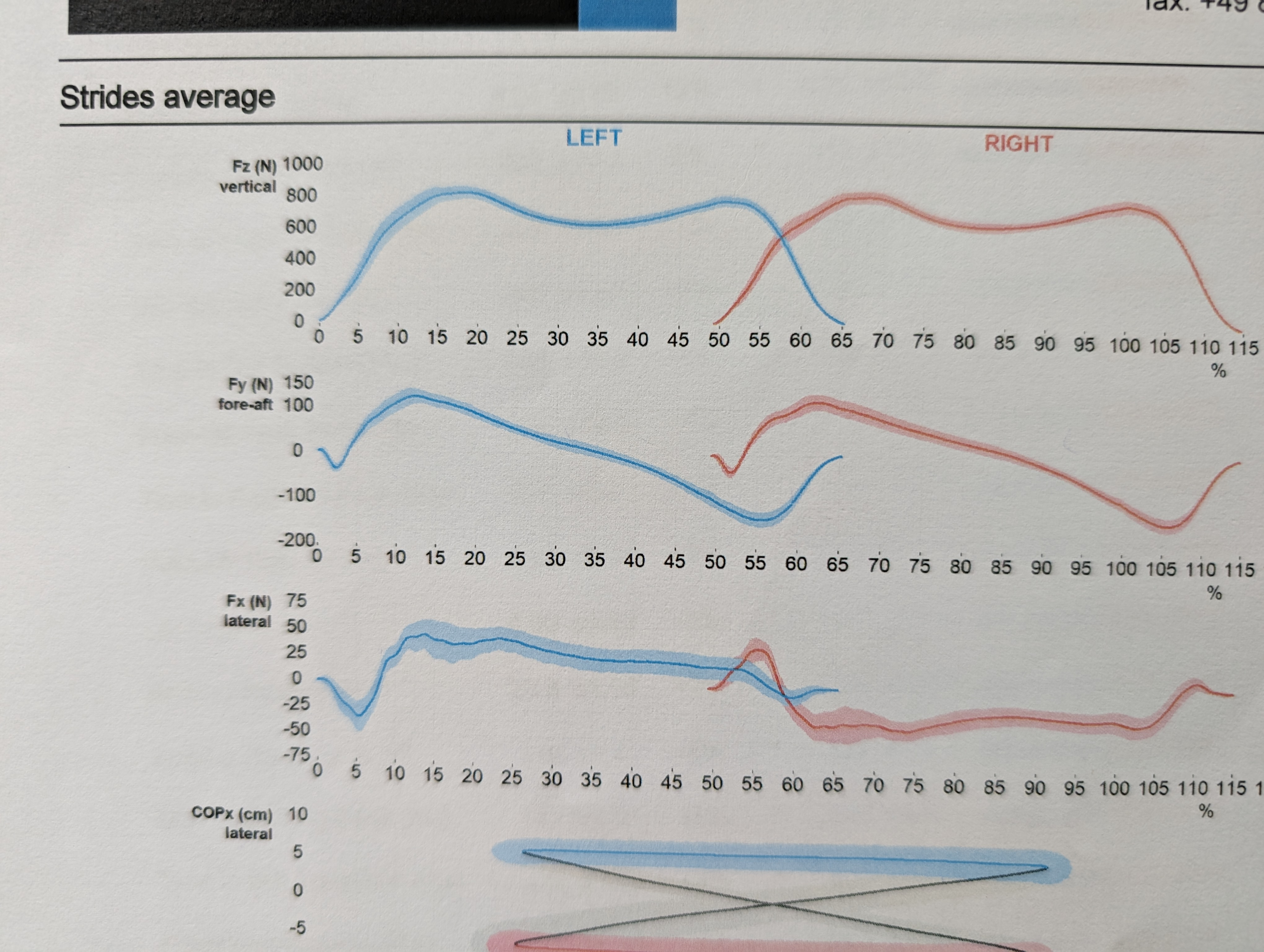 gait parameter results